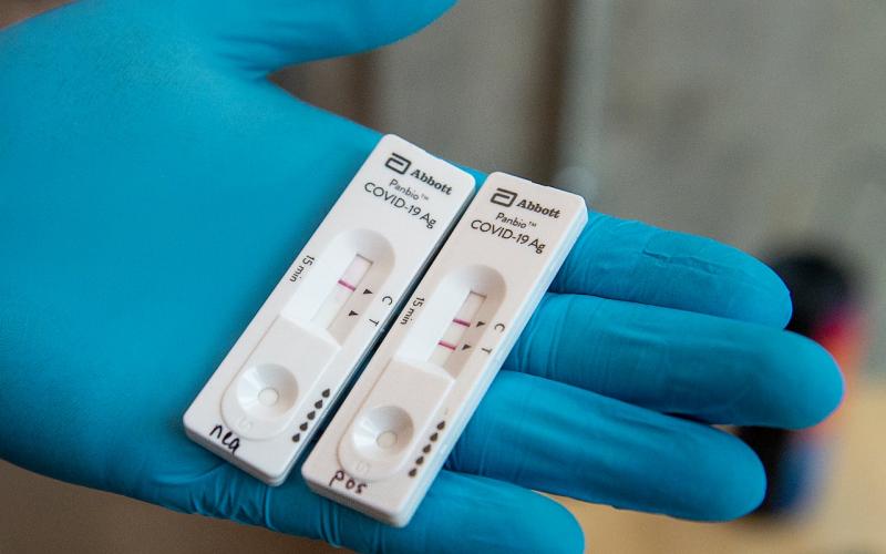 Ο Πανελλήνιος Ιατρικός Σύλλογος για τη μείωση τιμών στα PCR Tests